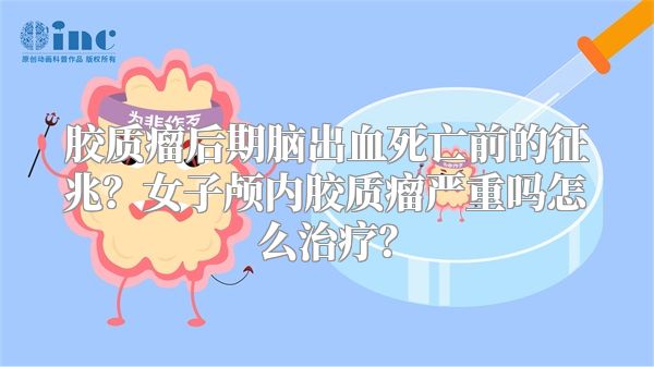 胶质瘤后期脑出血死亡前的征兆？女子颅内胶质瘤严重吗怎么治疗？