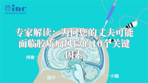 专家解读：为何您的丈夫可能面临胶质瘤风险的10个关键因素