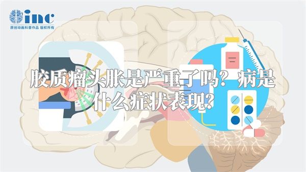 胶质瘤头胀是严重了吗？病是什么症状表现？