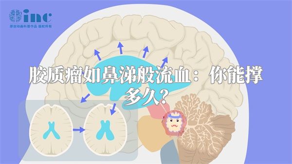 胶质瘤如鼻涕般流血：你能撑多久？