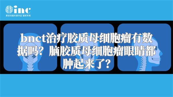 bnct治疗胶质母细胞瘤有数据吗？脑胶质母细胞瘤眼睛都肿起来了？