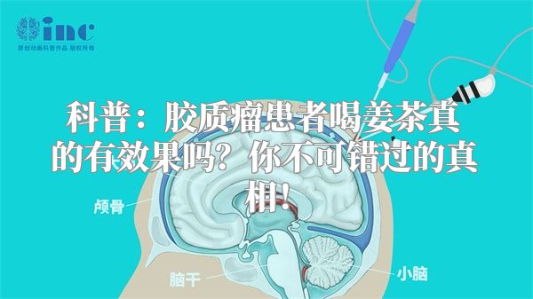 科普：胶质瘤患者喝姜茶真的有效果吗？你不可错过的真相！