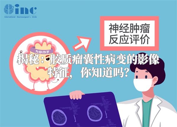 揭秘：胶质瘤囊性病变的影像特征，你知道吗？