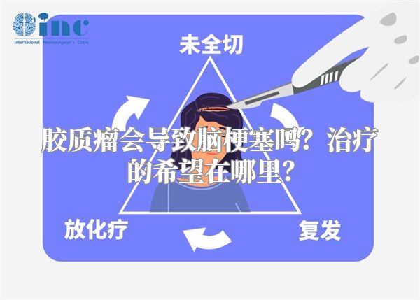 胶质瘤会导致脑梗塞吗？治疗的希望在哪里？