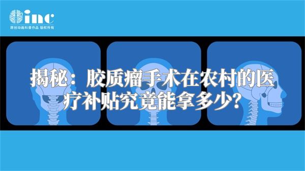 揭秘：胶质瘤手术在农村的医疗补贴究竟能拿多少？