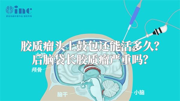 胶质瘤头上鼓包还能活多久？后脑袋长胶质瘤严重吗？