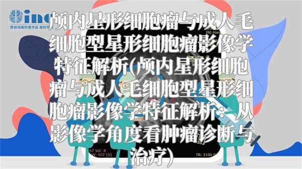 颅内星形细胞瘤与成人毛细胞型星形细胞瘤影像学特征解析(颅内星形细胞瘤与成人毛细胞型星形细胞瘤影像学特征解析：从影像学角度看肿瘤诊断与治疗)