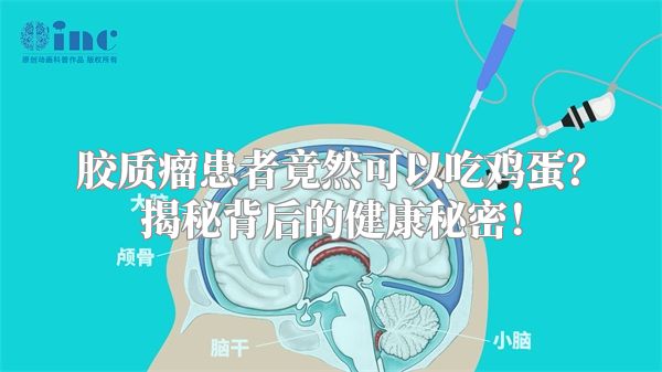 胶质瘤患者竟然可以吃鸡蛋？揭秘背后的健康秘密！