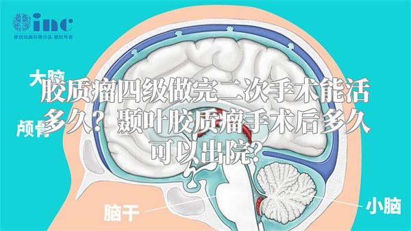 胶质瘤四级做完二次手术能活多久？颞叶胶质瘤手术后多久可以出院？