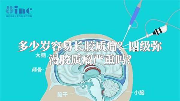 多少岁容易长胶质瘤？四级弥漫胶质瘤严重吗？