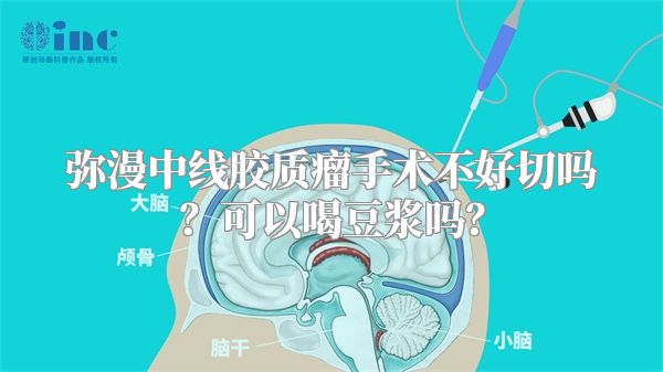 弥漫中线胶质瘤手术不好切吗？可以喝豆浆吗？