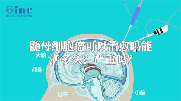 髓母细胞瘤可以治愈吗能活多久？严重吗？