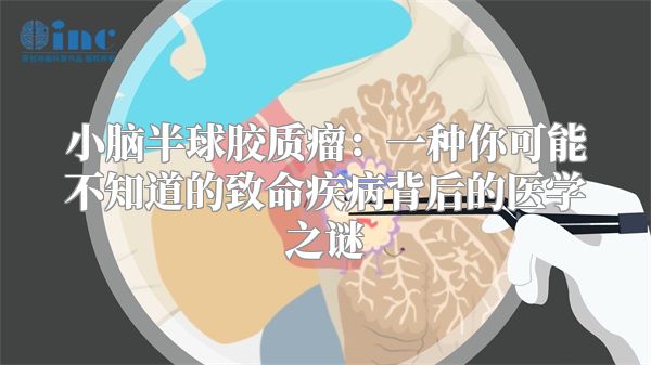 小脑半球胶质瘤：一种你可能不知道的致命疾病背后的医学之谜