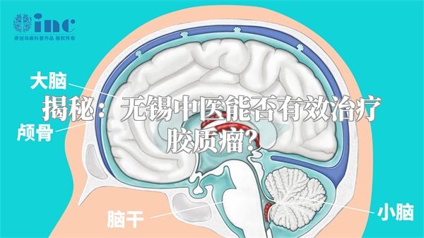 揭秘：无锡中医能否有效治疗胶质瘤？