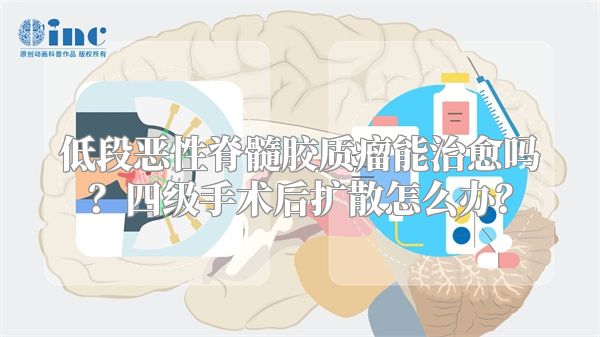 低段恶性脊髓胶质瘤能治愈吗？四级手术后扩散怎么办？