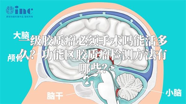 一级胶质瘤必须手术吗能活多久？功能区胶质瘤检测方法有哪些？