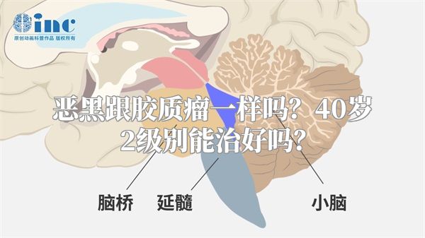 恶黑跟胶质瘤一样吗？40岁2级别能治好吗？