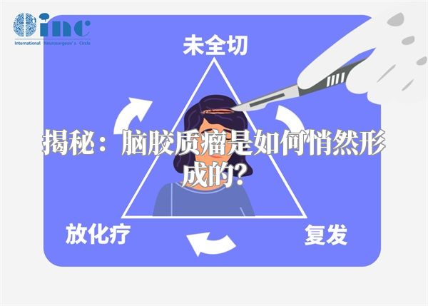 揭秘：脑胶质瘤是如何悄然形成的？