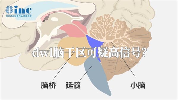 dwl脑干区可疑高信号？