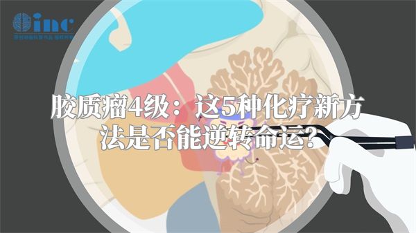 胶质瘤4级：这5种化疗新方法是否能逆转命运？