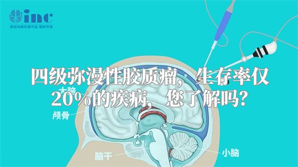 四级弥漫性胶质瘤，生存率仅20%的疾病，您了解吗？