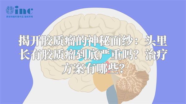 揭开胶质瘤的神秘面纱：头里长有胶质瘤到底严重吗？治疗方案有哪些？