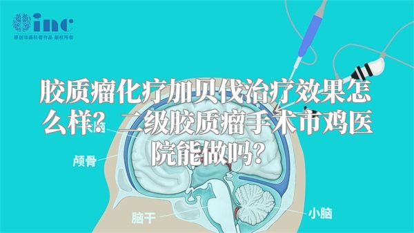 胶质瘤化疗加贝伐治疗效果怎么样？二级胶质瘤手术市鸡医院能做吗？