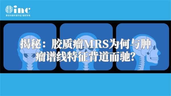 揭秘：胶质瘤MRS为何与肿瘤谱线特征背道而驰？