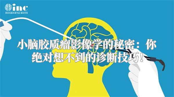 小脑胶质瘤影像学的秘密：你绝对想不到的诊断技巧！