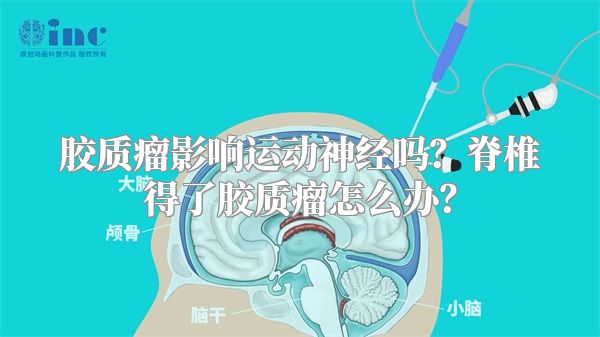 胶质瘤影响运动神经吗？脊椎得了胶质瘤怎么办？