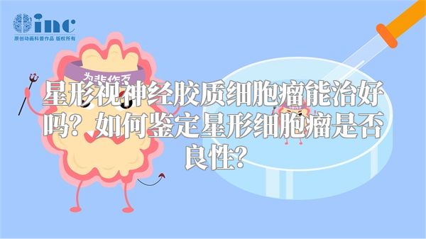 星形视神经胶质细胞瘤能治好吗？如何鉴定星形细胞瘤是否良性？