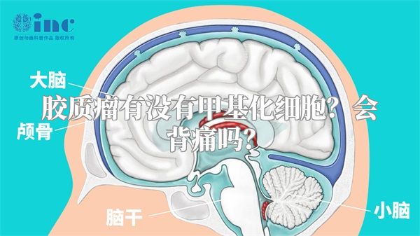 胶质瘤有没有甲基化细胞？会背痛吗？