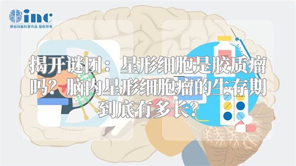 揭开谜团：星形细胞是胶质瘤吗？脑内星形细胞瘤的生存期到底有多长？