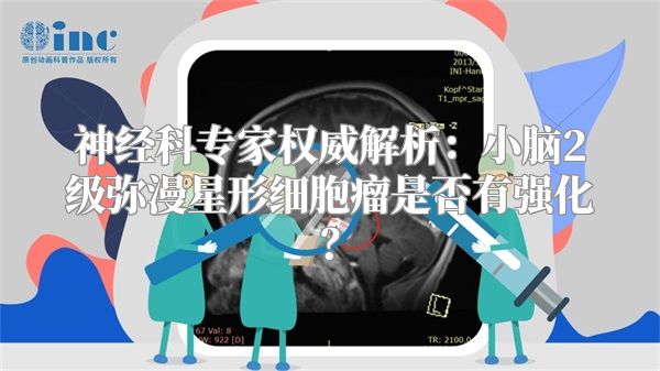 神经科专家权威解析：小脑2级弥漫星形细胞瘤是否有强化？