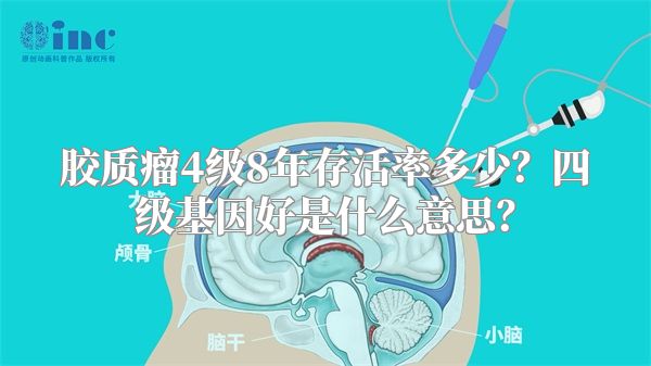 胶质瘤4级8年存活率多少？四级基因好是什么意思？