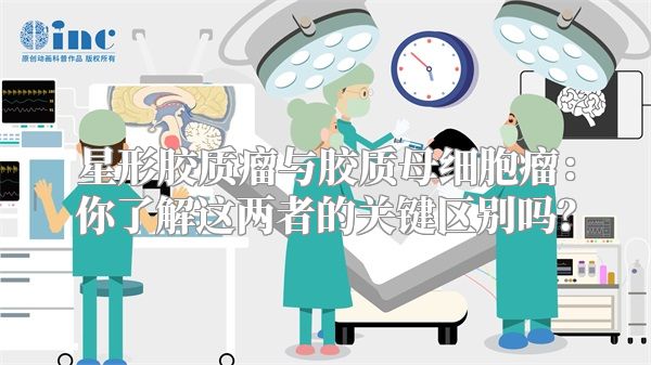 星形胶质瘤与胶质母细胞瘤：你了解这两者的关键区别吗？