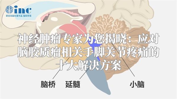 神经肿瘤专家为您揭晓：应对脑胶质瘤相关手脚关节疼痛的十大解决方案