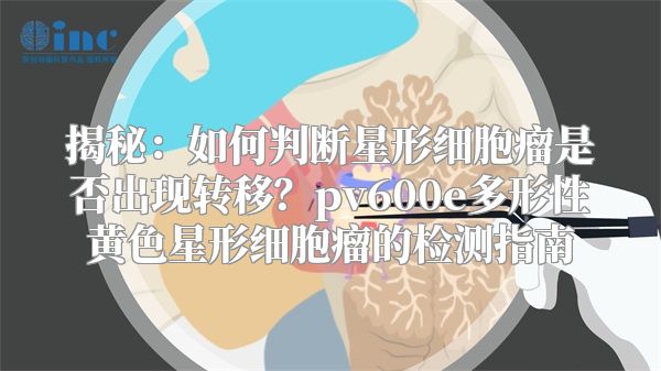 揭秘：如何判断星形细胞瘤是否出现转移？pv600e多形性黄色星形细胞瘤的检测指南