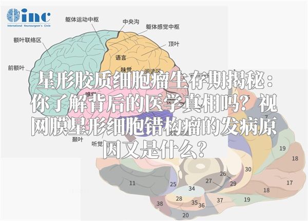 星形胶质细胞瘤生存期揭秘：你了解背后的医学真相吗？视网膜星形细胞错构瘤的发病原因又是什么？