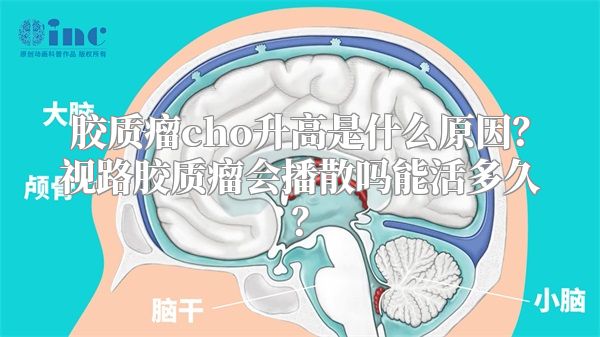 胶质瘤cho升高是什么原因？视路胶质瘤会播散吗能活多久？