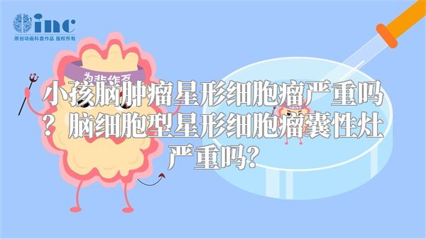 小孩脑肿瘤星形细胞瘤严重吗？脑细胞型星形细胞瘤囊性灶严重吗？