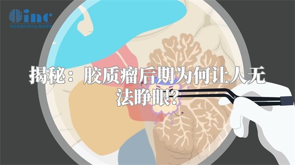 揭秘：胶质瘤后期为何让人无法睁眼？