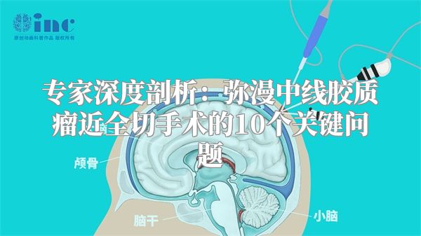 专家深度剖析：弥漫中线胶质瘤近全切手术的10个关键问题