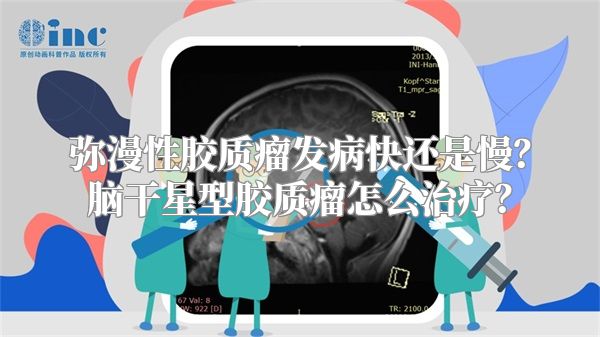 弥漫性胶质瘤发病快还是慢？脑干星型胶质瘤怎么治疗？