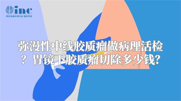 弥漫性中线胶质瘤做病理活检？胃镜下胶质瘤切除多少钱？