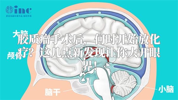 胶质瘤手术后，何时开始放化疗？这几点新发现让你大开眼界！