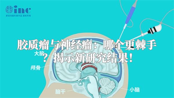 胶质瘤与神经瘤：哪个更棘手？揭示新研究结果！