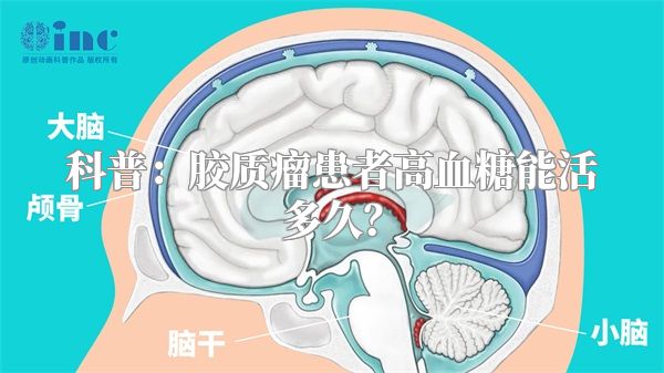 科普：胶质瘤患者高血糖能活多久？