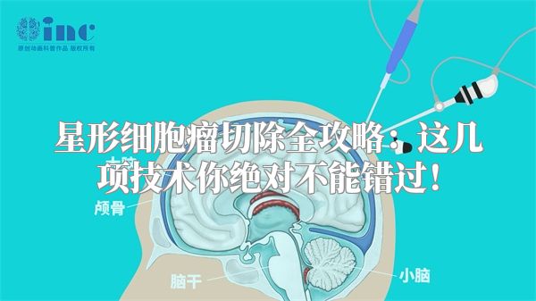 星形细胞瘤切除全攻略：这几项技术你绝对不能错过！