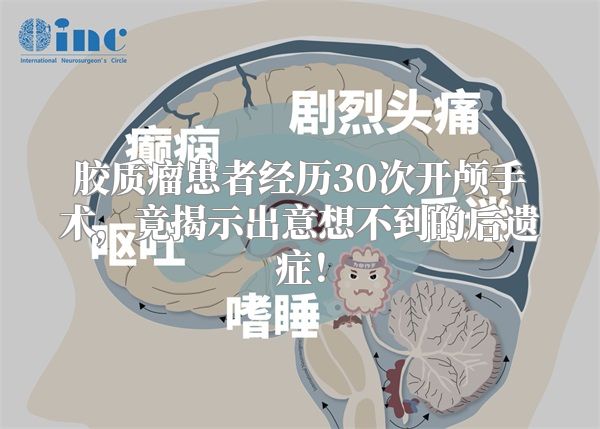 胶质瘤患者经历30次开颅手术，竟揭示出意想不到的后遗症！